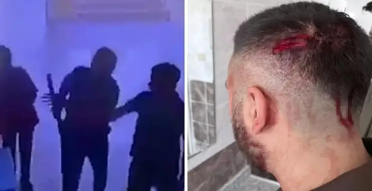 Şanlıurfa’da Öğretmene veliden sopalı saldırı, Saldırgan veli tutuklandı